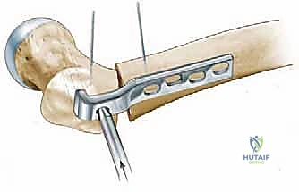 Clinical Image