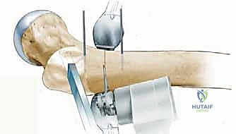 Clinical Image
