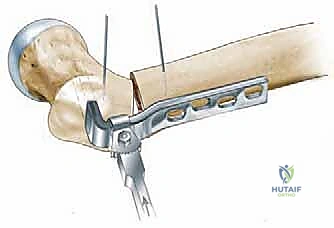 Clinical Image