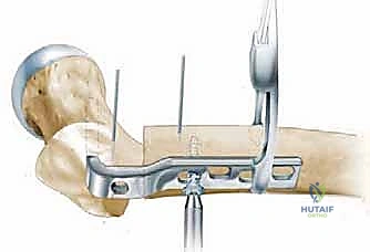 Clinical Image