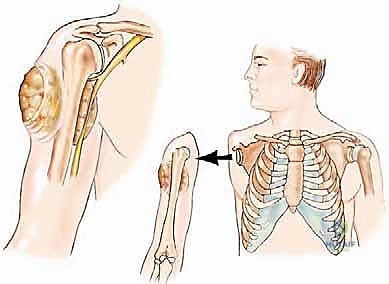 الأستاذ الدكتور محمد هطيف أثناء الجراحة