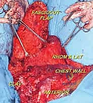 خياطة الجرح التجميلية