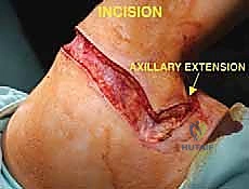 تقييم حالة المريض قبل الجراحة