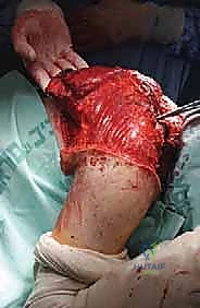 مناقشة الخيارات العلاجية مع المريض