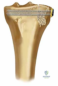 Clinical Image
