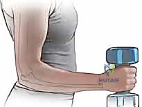 كسور الزند البعيد غالبًا ما يتم إهمالها مقارنة بكسور الكعبرة