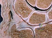 صورة توضيحية لـ علاج كسور عظم الزند: دليل شامل لكسور الناتئ الإبري، الرأس، والجزء الكردوسي الكردوسي مع الأستاذ الدكتور محمد هطيف في صنعاء