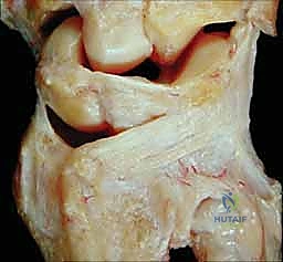 صورة طبية: علاج كسور عظم الزند: دليل شامل لكسور الناتئ الإبري، الرأس، والجزء الكردوسي الكردوسي مع الأستاذ الدكتور محمد هطيف في صنعاء