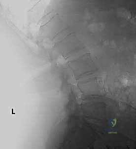 الأستاذ الدكتور محمد هطيف أثناء إجراء الجراحة
