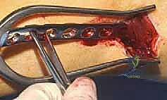 Clinical Image