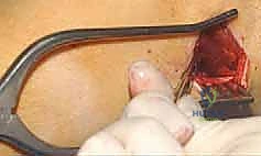 Clinical Image