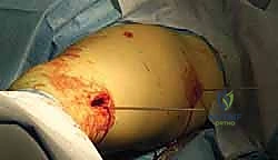 Clinical Image