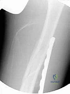 Clinical Image