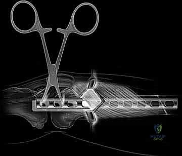 Clinical Image