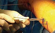 Clinical Image