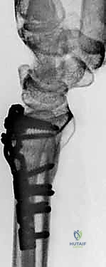 Clinical Image