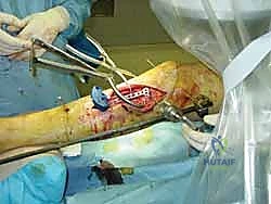 Clinical Image