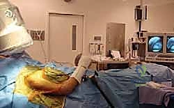 تأثير العضلات على الكسر