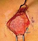 صورة مقارنة بين العلاجات