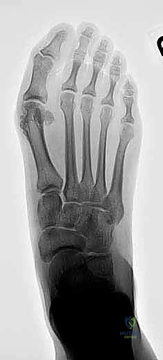 Figure for Trauma 2009 MCQs - Part 4 - Question 76