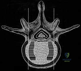 Clinical Image