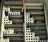 استئصال الجسم الفقري الصدري الأمامي مع الدكتور محمد هطيف