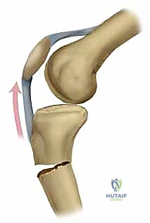 Clinical Image