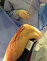 Clinical Image