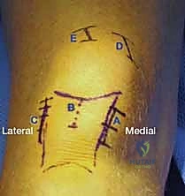 Clinical Image
