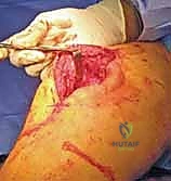Clinical Image