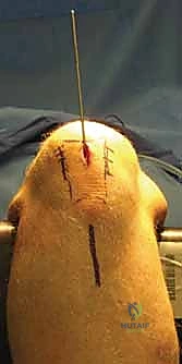 Clinical Image