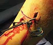 Clinical Image