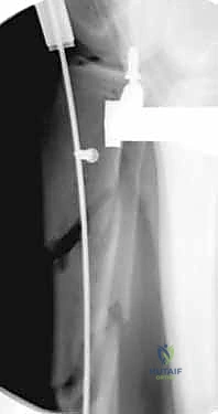 Clinical Image