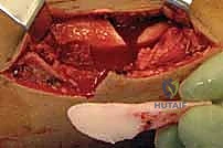 Clinical Image