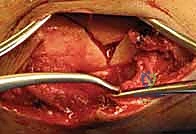 Clinical Image