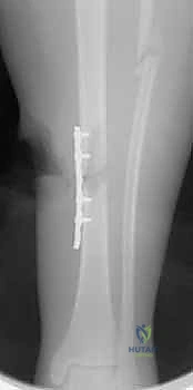 Clinical Image