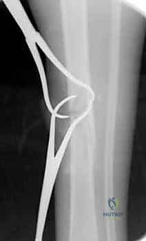 Clinical Image