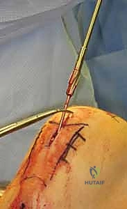 Clinical Image
