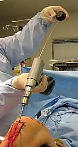 Clinical Image