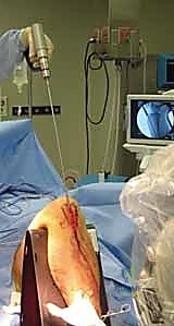 Clinical Image
