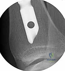 Clinical Image