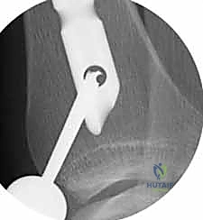 Clinical Image