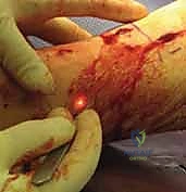 Clinical Image