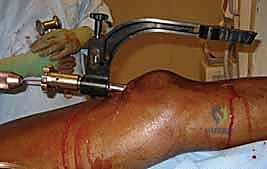 Clinical Image
