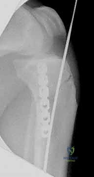 Clinical Image