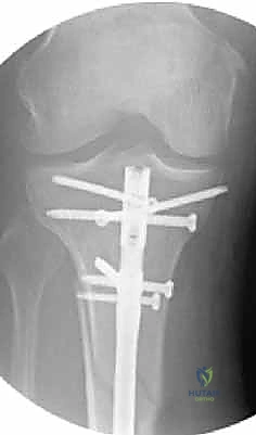 Clinical Image
