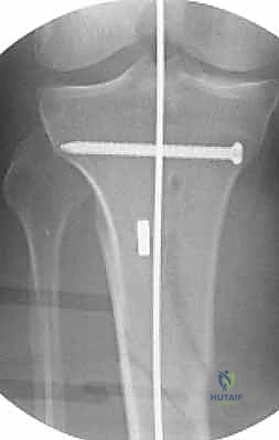 Clinical Image