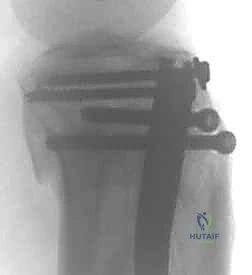 Clinical Image