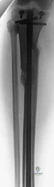 Clinical Image