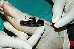 الإغلاق التجميلي للجرح ووضع الضمادات